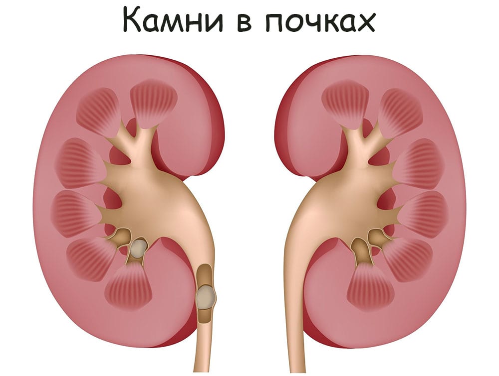 Кракен ссылка зеркало